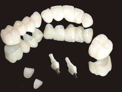 MIM注射成型陶(táo)瓷牙 MIM注射成(chéng)型陶瓷牙